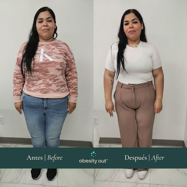 Slider image (8) Obesity Out Bariatric Surgery Center